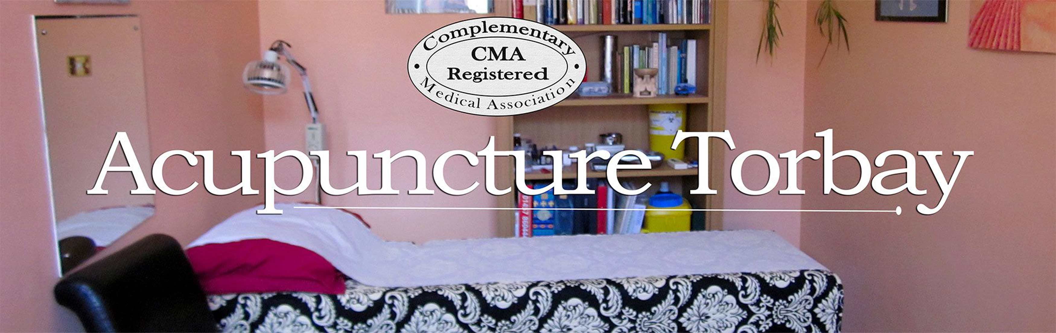 Acupuncture Torbay Banner