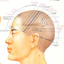 Scalp Acupuncture diagram