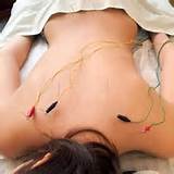 Electro Acupuncture to the shoulder